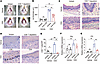 CD8+ T cells are essential for the development of an OLP-like model.