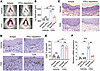 Neutralization of IFN-γ ameliorates OLP-like lesions.