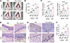 Local IFN-γ priming exacerbates OLP-like lesions by upregulating MHC I expr