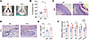 Absence of Langerhans cells exacerbates OLP-like lesions.