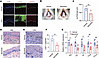 The JAK inhibitor baricitinib ameliorates OLP-like lesions.