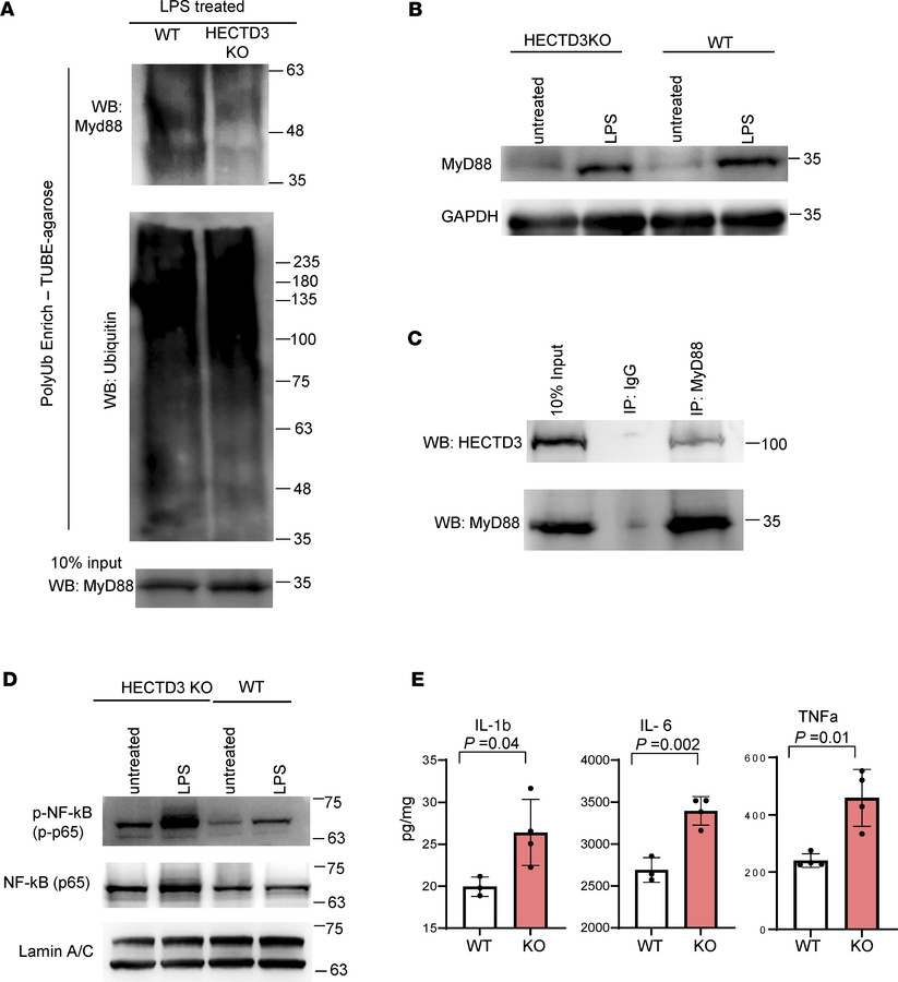 HECTD3 interacts with MyD88 and promotes its polyubiquitination dampenin...