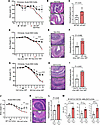 HECTD3 deficiency in hematopoietic system including in CD11c+ cells exacerb