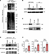HECTD3 interacts with MyD88 and promotes its polyubiquitination dampening N