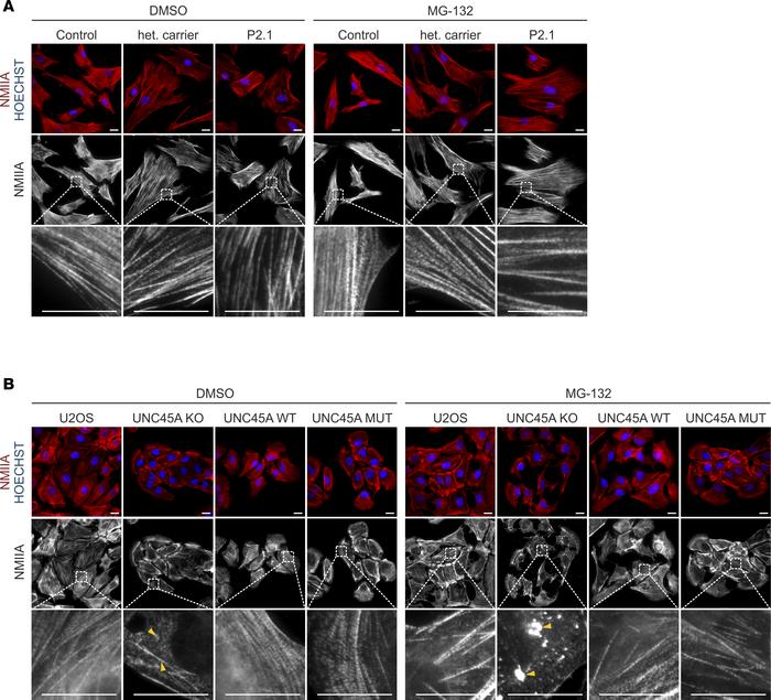 Epifluorescence microscopy showing the UNC45A mutant to retain chaperone...