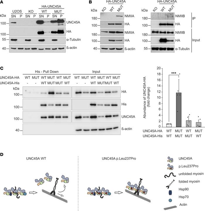 Oligomerization of the UNC45A p.Leu237Pro variant and complex formation ...