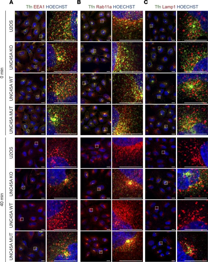 Confocal IF characterization of Tfn-containing endocytic compartments in...