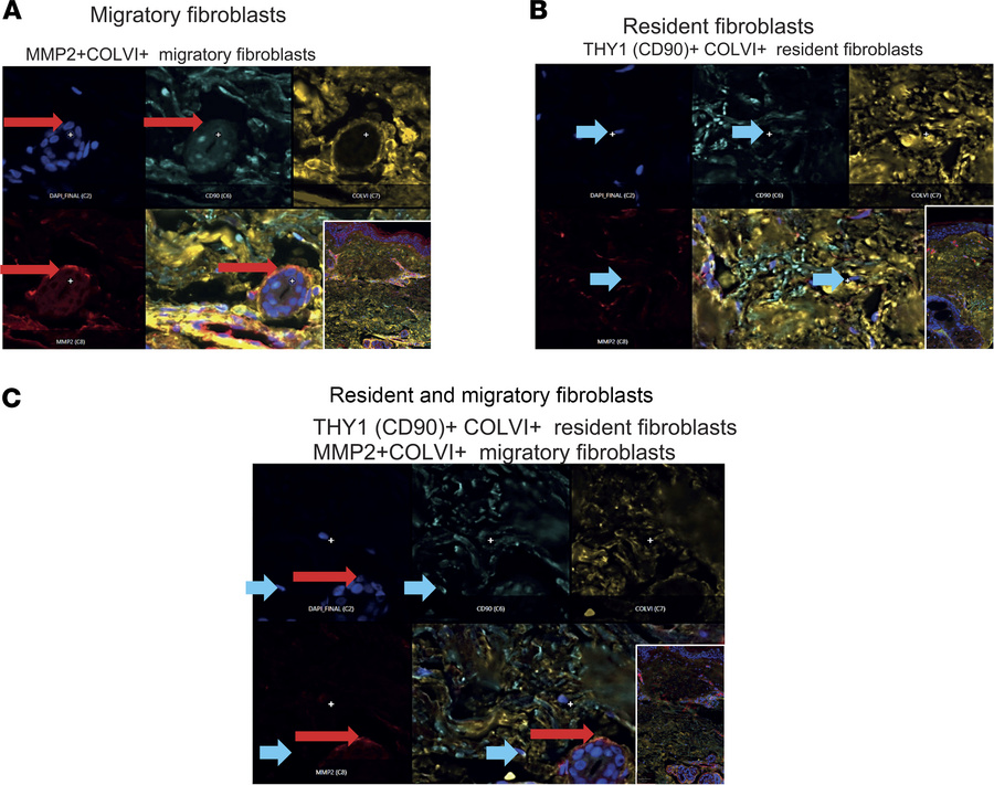 Distinct localization of resident and migratory fibroblast populations i...