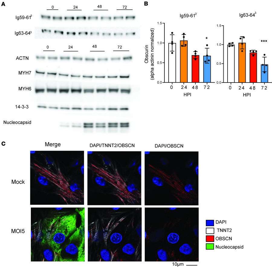 Obscurin degradation in SARS-COV2 infection.
(A) Western blots of WTC-11...