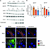 Obscurin degradation in SARS-COV2 infection.