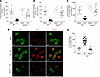 BDKRB1 activation induces PI3Kγ activation and desensitization of CXCR2 in