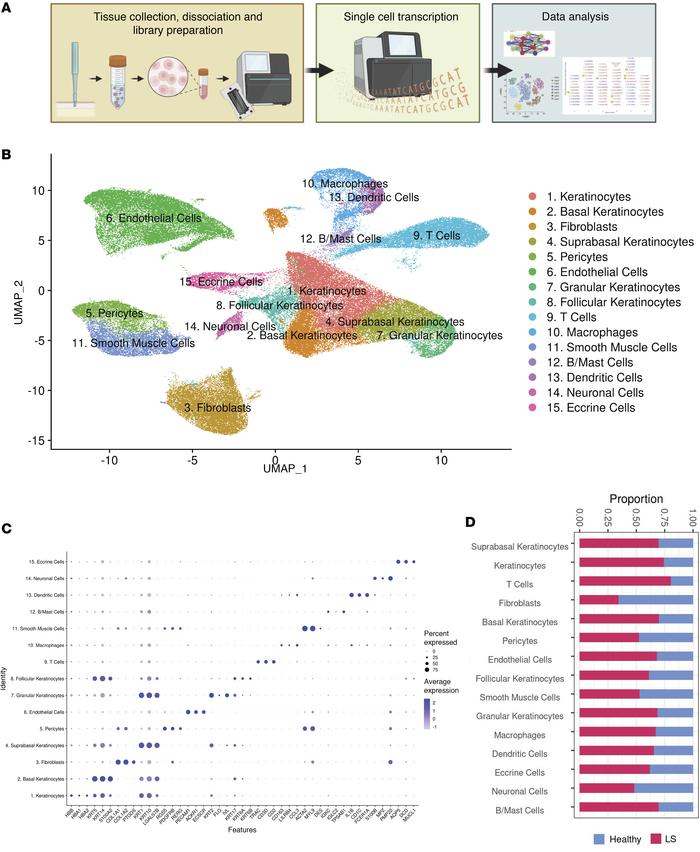 scRNA-Seq defines cell populations in the skin of patients with LS compa...