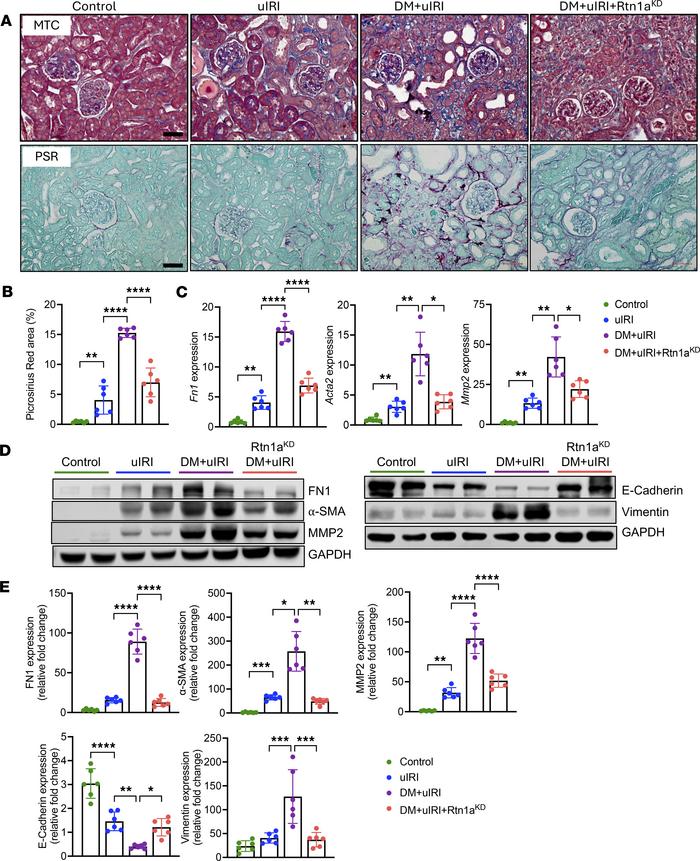 Diabetes predisposes mice to increased renal fibrosis after uIRI, which ...