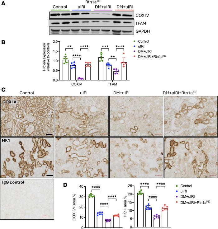 Diabetes predisposes mice to increased mitochondrial damage in injured t...