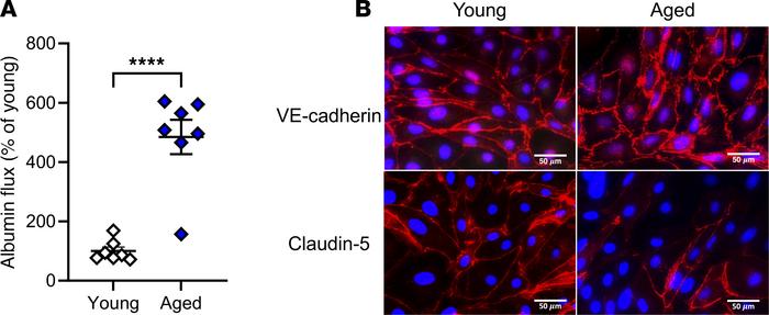 Assessment of endothelial barrier integrity in isolated PMVEC from young...
