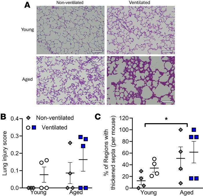 Lung histology, lung injury score, and alveolar septal thickness analysi...