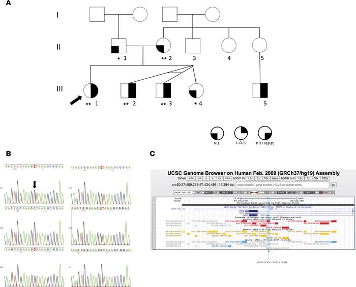 Pedigree of family 2 and identified intronic point variant.
(A) Pedigree...