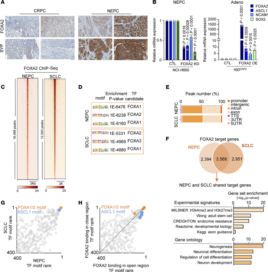 FOXA2 in NEPC.
(A) Immunohistochemical staining for FOXA2 and SYP in CRP...