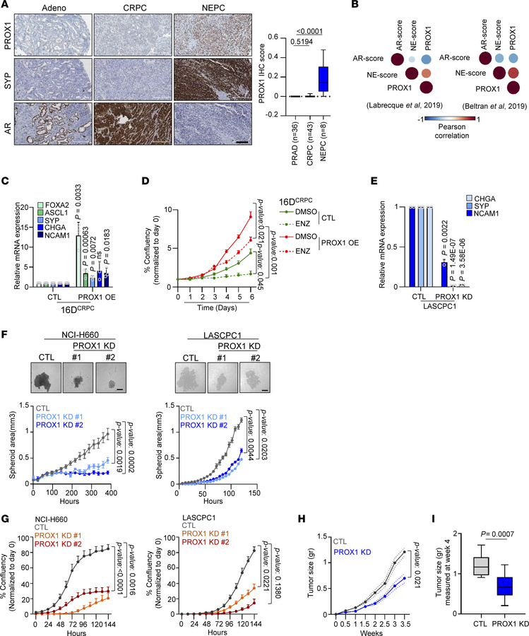 PROX1 is required for neuroendocrine phenotype characteristics and proli...