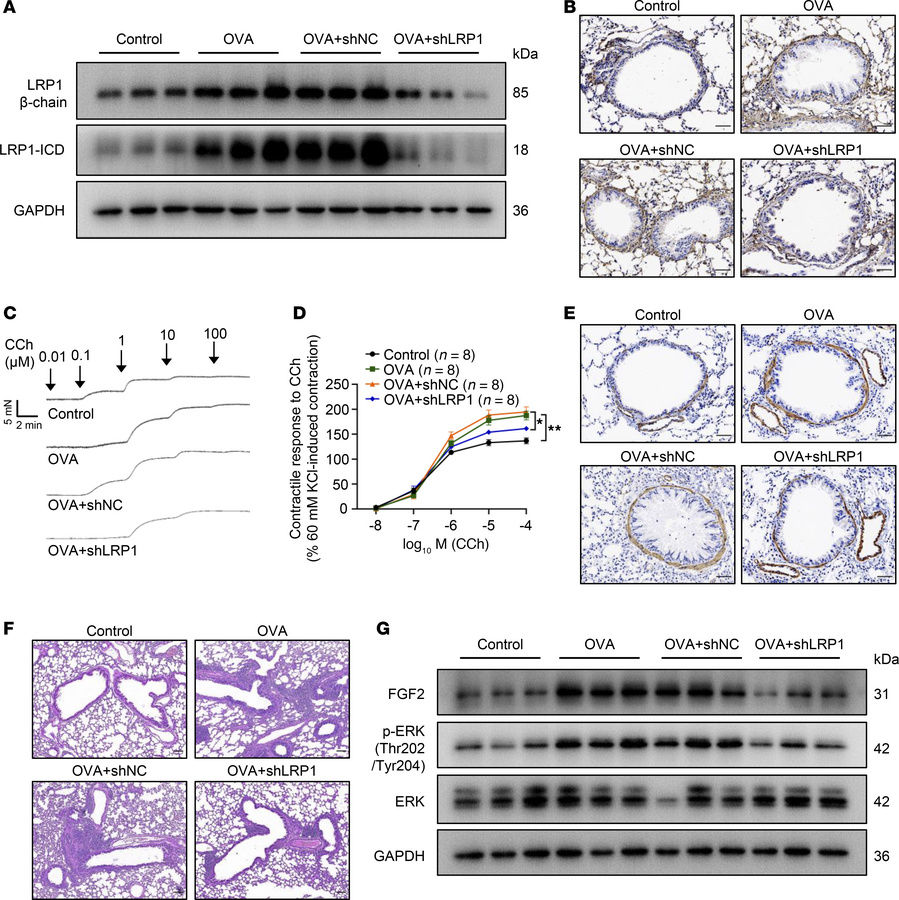 
Lrp1 knockdown attenuates ASM proliferation in mice with OVA-induced ch...