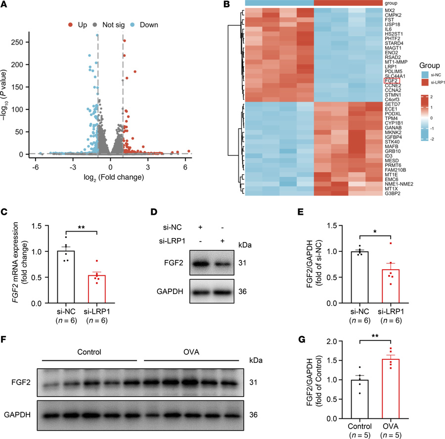 FGF2 is a downstream molecule potentially regulated by LRP1.
(A) HBSMCs ...