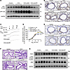 Lrp1 knockdown attenuates ASM proliferation in mice with OVA-induced chroni