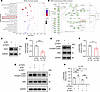 LRP1 knockdown inhibits the MAPK signaling pathway by suppressing FGF2 expr