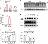 Upregulation of MT1-MMP expression in tracheal tissues of mice with OVA-ind