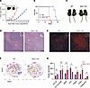 NAC1 deficiency supports tumor growth in mice.