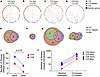TCR sequences shared between pancreatic tissues of organ donors with or wit