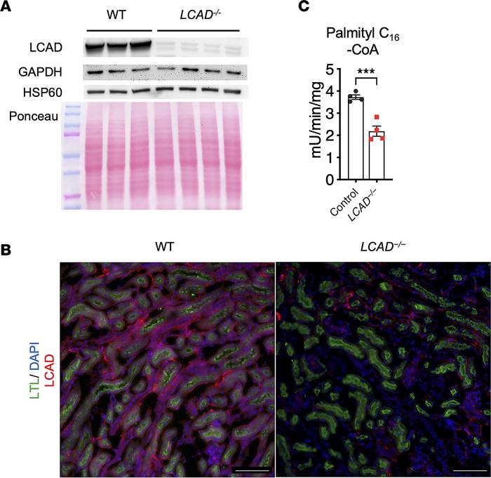 LCAD expression in the kidneys.
(A) Anti-LCAD immunoblot in LCAD–/– vers...