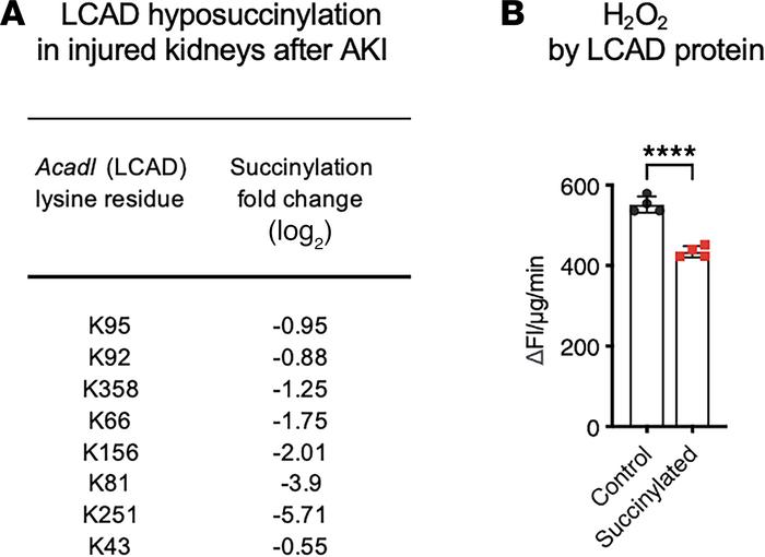 LCAD succinylation linked to renoprotection.
(A) Mass spectrometry revea...