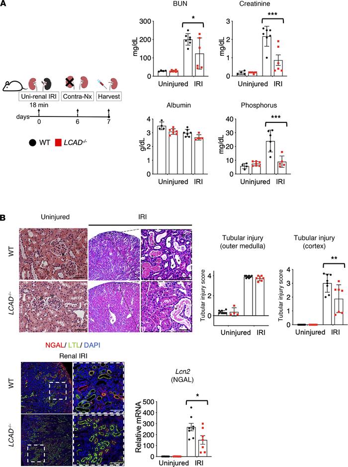 
LCAD–/– kidneys are protective against ischemic-AKI.
(A) Schematic of i...