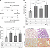 Reconstitution of PAI-1–/–:VTN–/– mice with PAI-1RR restores pulmonary fibr