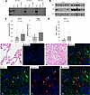 PAI-1WT binds to SorLA in lung tissue homogenates from patients with IPF.