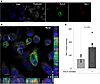 PAI-1 colocalizes with SorLA in cells.