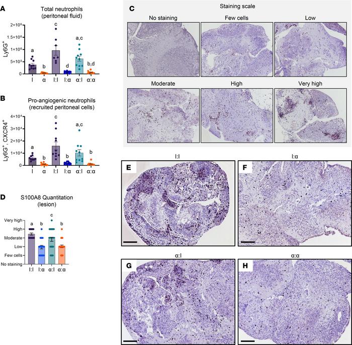 Knockdown of neutrophil recruitment in the SDME model decreased total an...