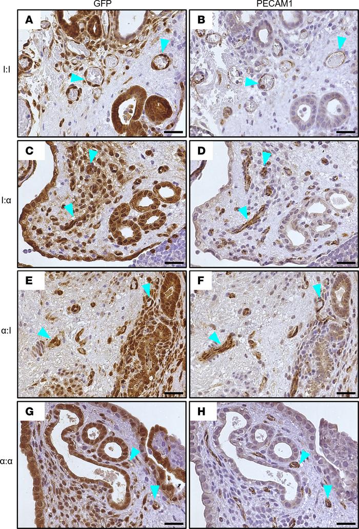 Endometriosis lesions include existing GFP+ donor-derived blood vessels ...