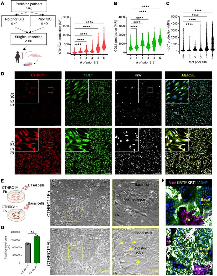 Repeated SIS in the airway leads to CTHRC1+ Fb activation and affects fi...