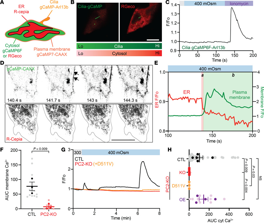 Hyperosmotic stimuli induce ER-localized PC2 calcium release.
(A) Diagra...
