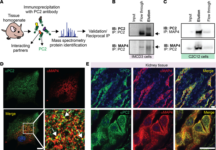 PC2 interacts with microtubule-associated protein 4 (MAP4).
(A) Diagram ...