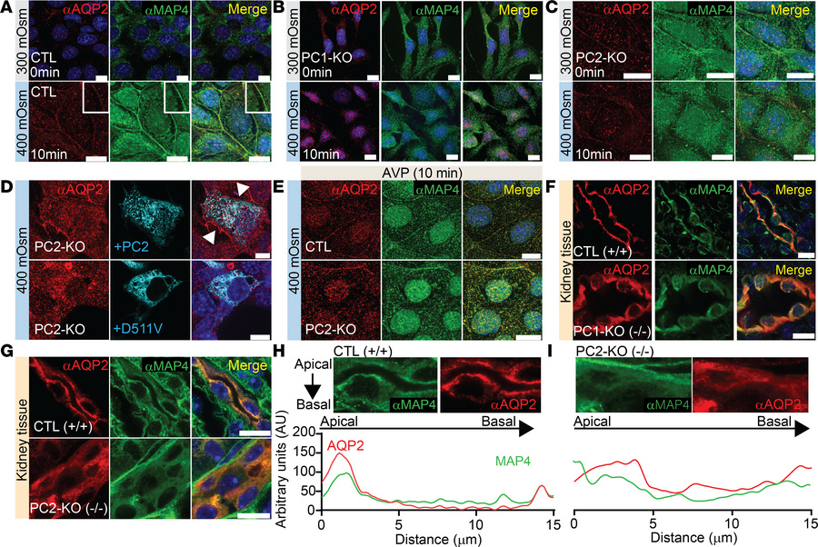Hyperosmotic aquaporin 2 (AQP2) trafficking to the membrane is impaired ...