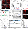 MAP4 is an upstream interactor of the PC2-mediated osmosensing pathway.