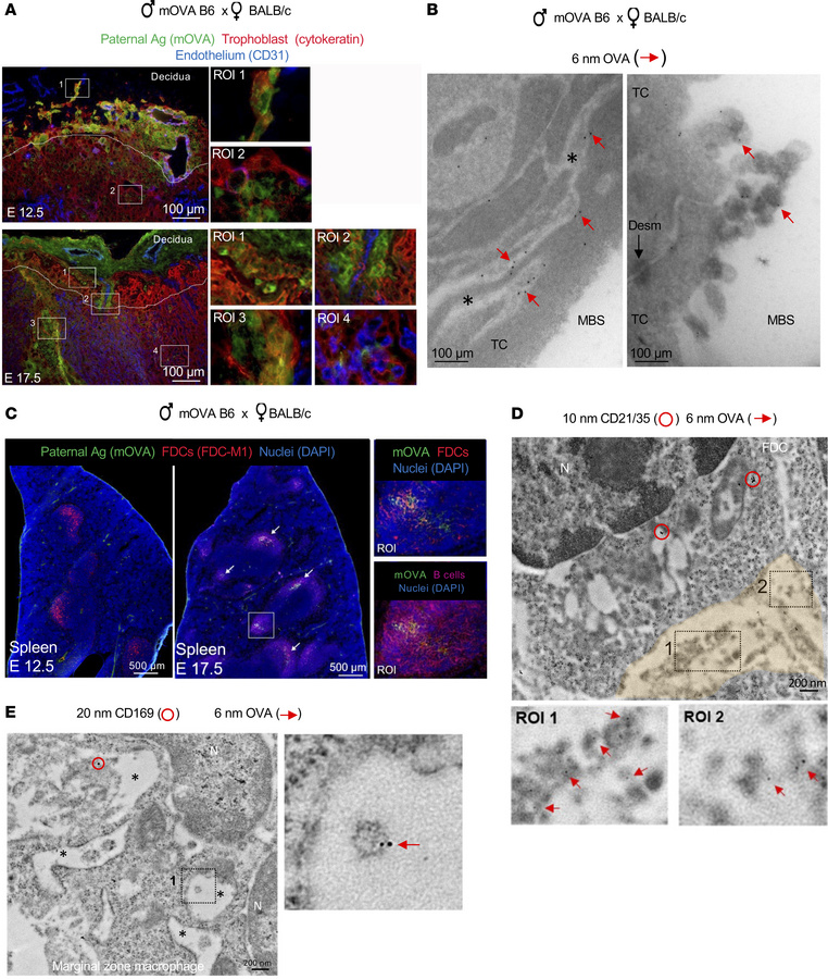 Fetoplacental Ags are relayed to maternal immune cells via sEVs.
(A) Mic...