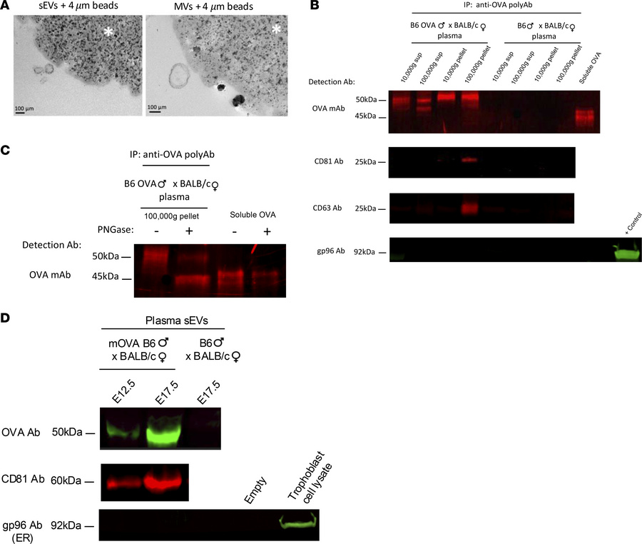Maternal plasma carries paternal Ag associated with EVs and in soluble f...