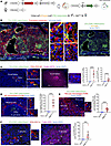 Fetoplacental CD81 sEVs traffic to the maternal spleen.