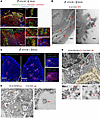 Fetoplacental Ags are relayed to maternal immune cells via sEVs.