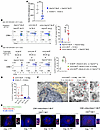 Reduction of release of fetoplacental sEVs decreases maternal T cell recogn