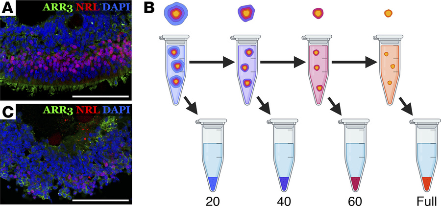 Overview.
(A) Patient iPSC-derived retinal organoids (day 160) showing c...