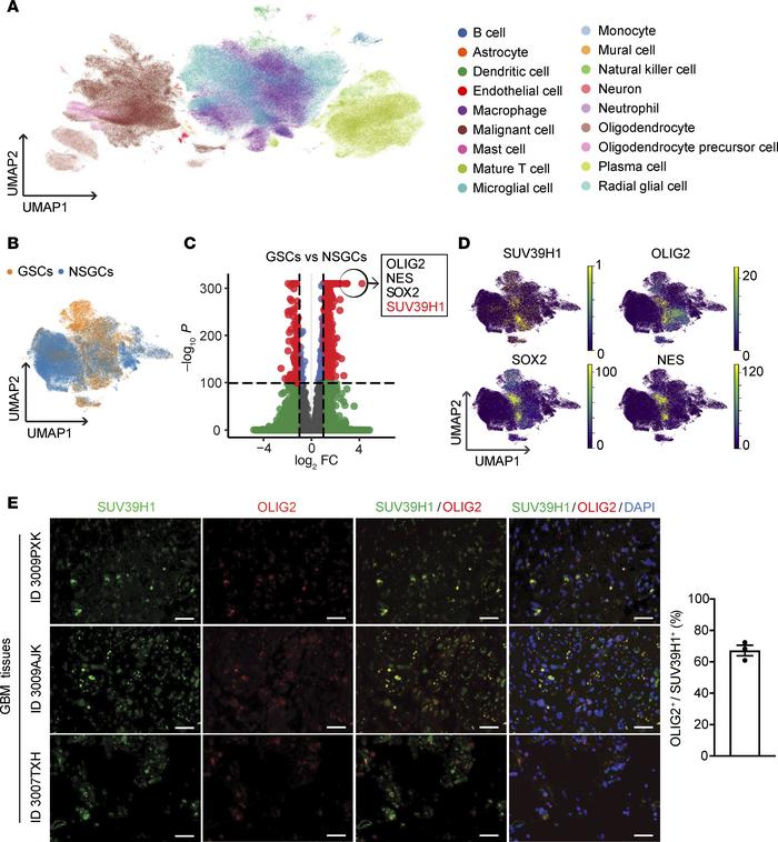 Expression patterns of SUV39H1 in GBM.
(A) The UMAP clustering of single...